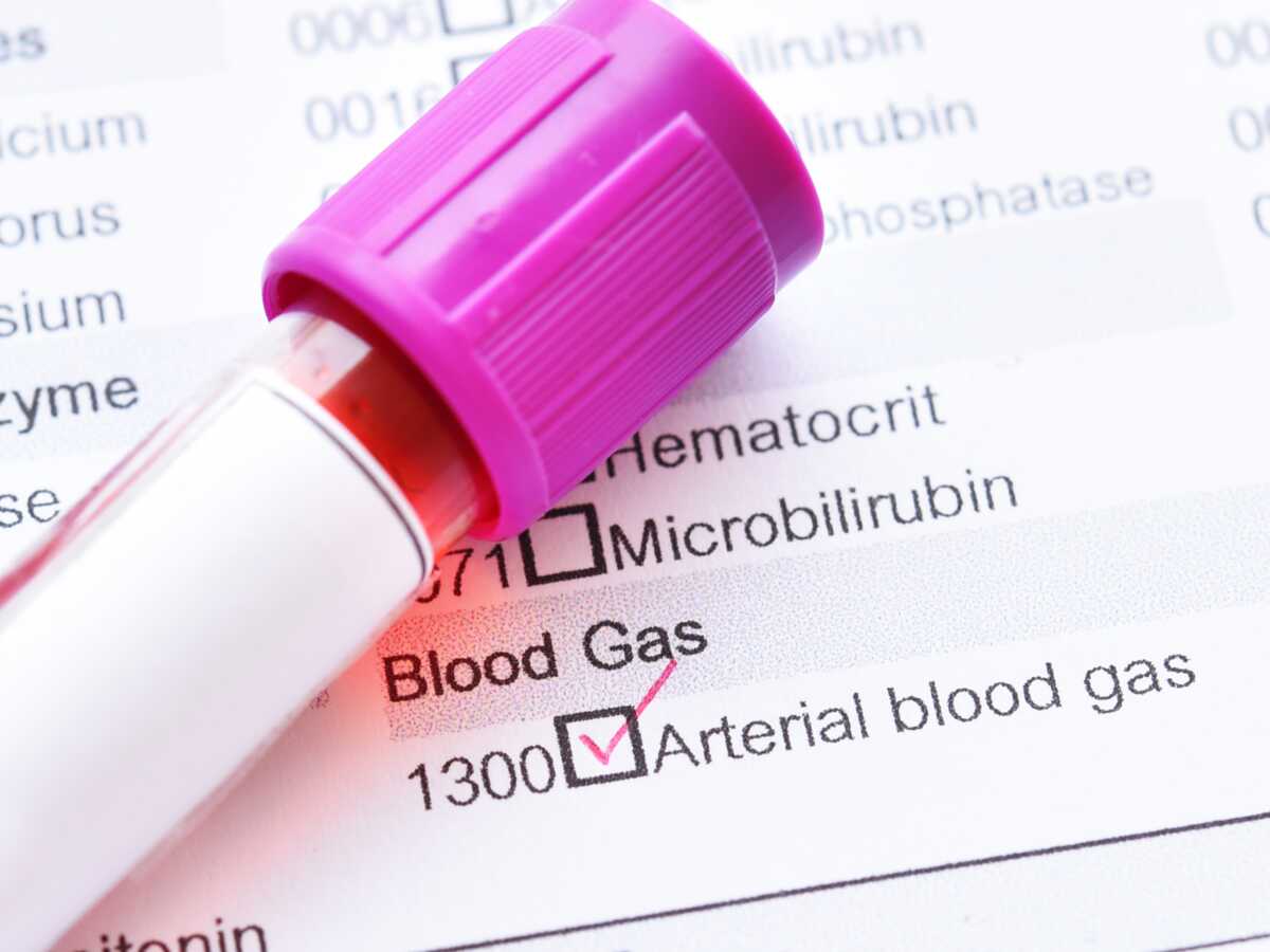 Gaz du sang  (gazométrie artérielle) : dans quel cas est-ce nécessaire ?