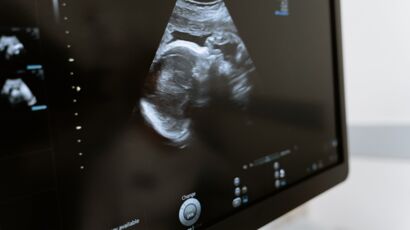 Grossesse, la 3ème échographie de bébé 