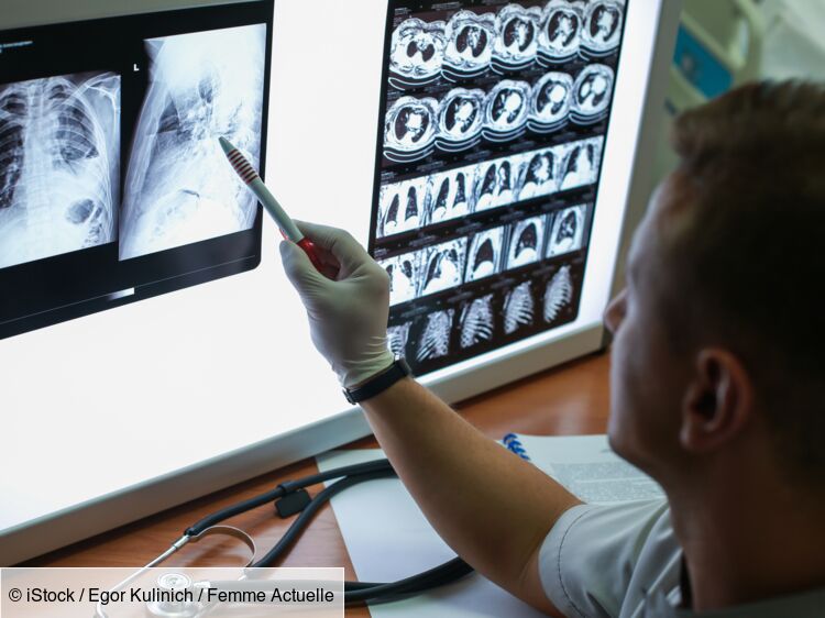 Cancer du poumon "non opérable" : qu’est-ce que ça signifie ?