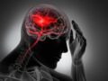 Cerveau : rôle, anatomie et pathologies