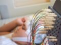 Électrochoc : définition, utilité et convalescence