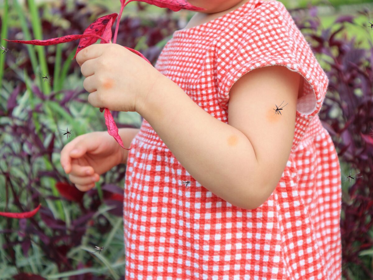 Piqûres d'insectes chez l'enfant ou le bébé : les meilleures solutions pour les prévenir et les soulager