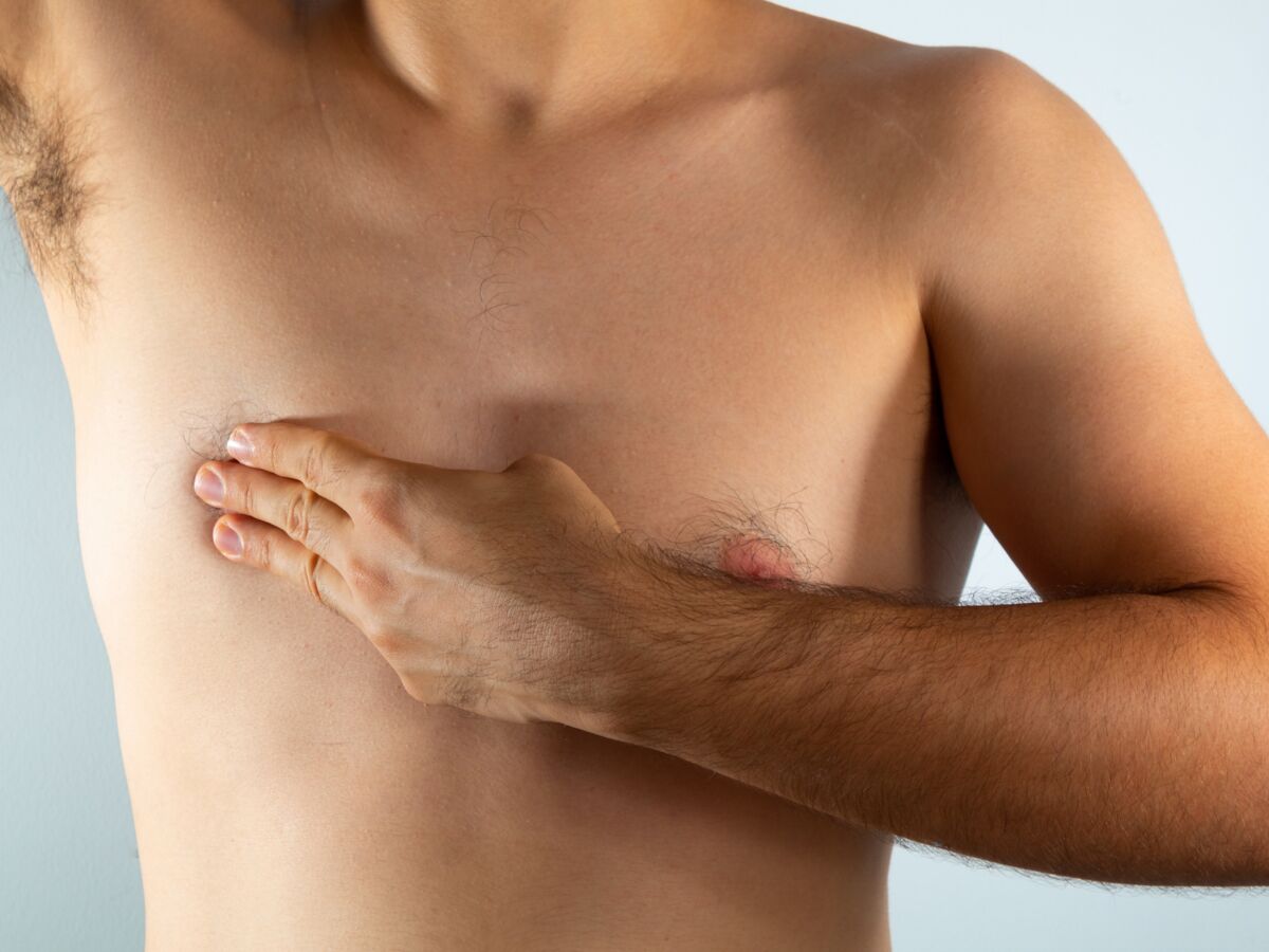 Cancer du sein chez l'homme : ce facteur doublerait les risques