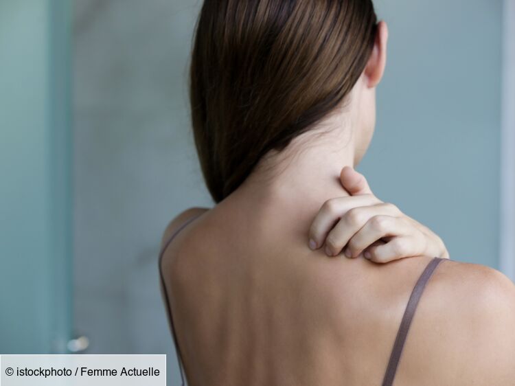 Boutons de transpiration comment s’en débarrasser ? Femme Actuelle Le MAG