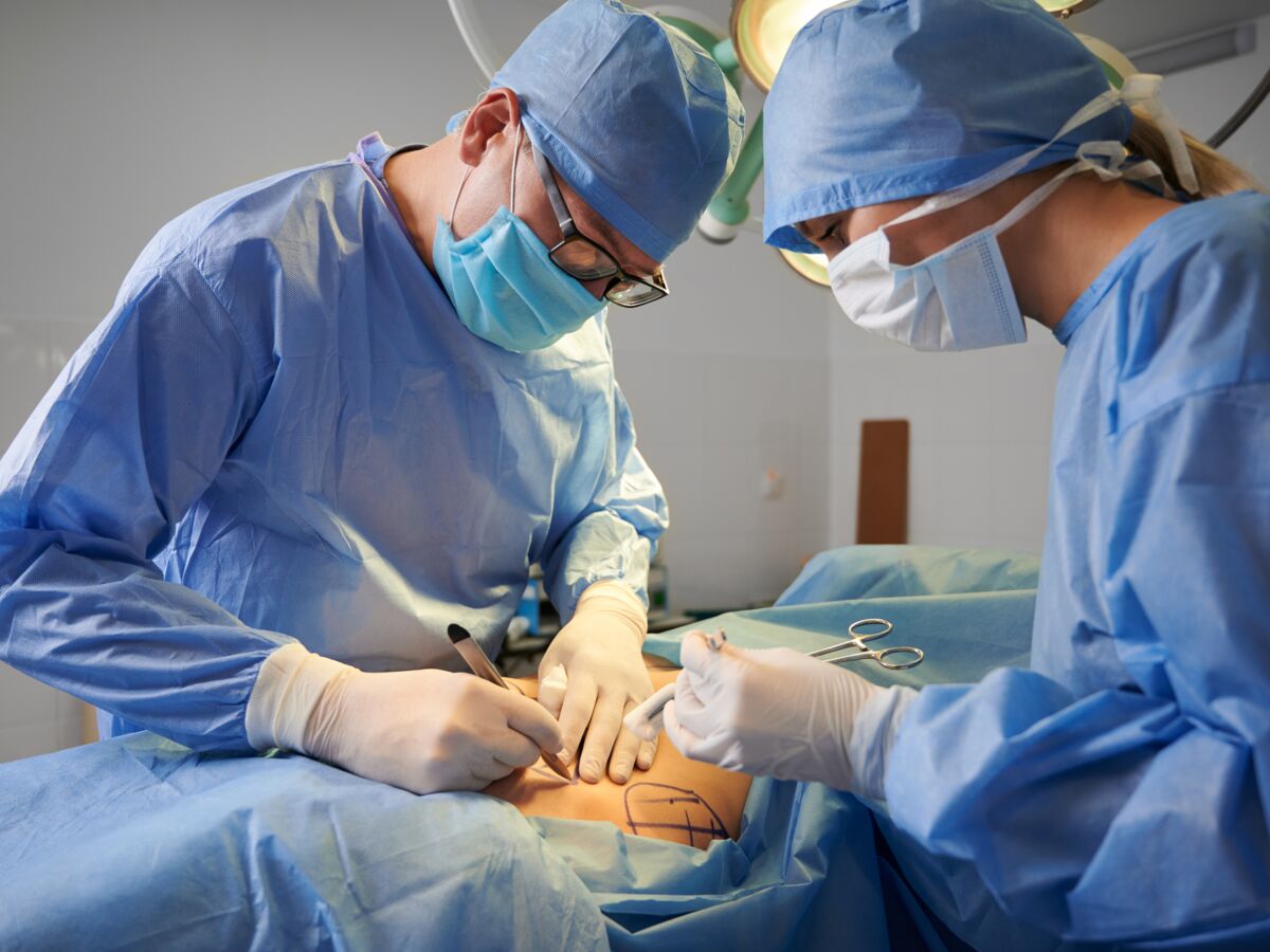 Plastie abdominale : déroulement de l'opération, tarif, prise en charge, cicatrices post-abdominoplastie