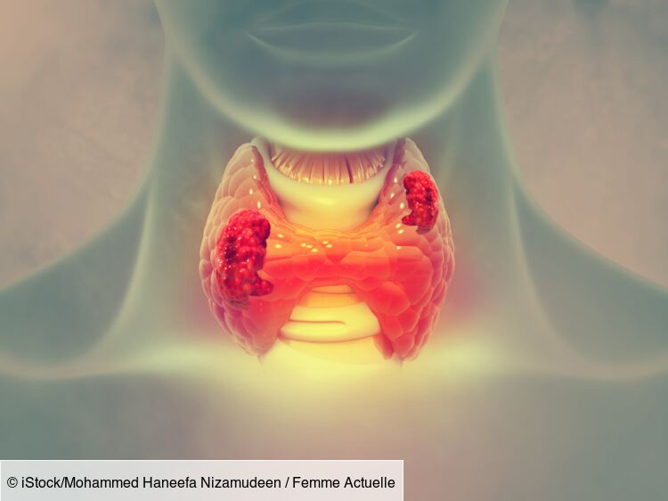 Hyperparathyroïdie (primaire, secondaire, tertiaire) : symptômes, conséquences, traitement