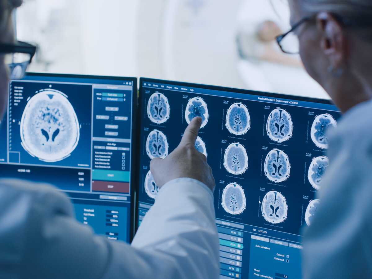 Une IRM suffira-t-elle bientôt à diagnostiquer la maladie d’Alzheimer ?