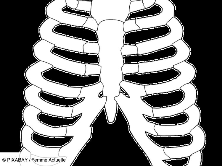 Syndrome de Tietze : causes, symptômes, diagnostic, traitement : Femme ...