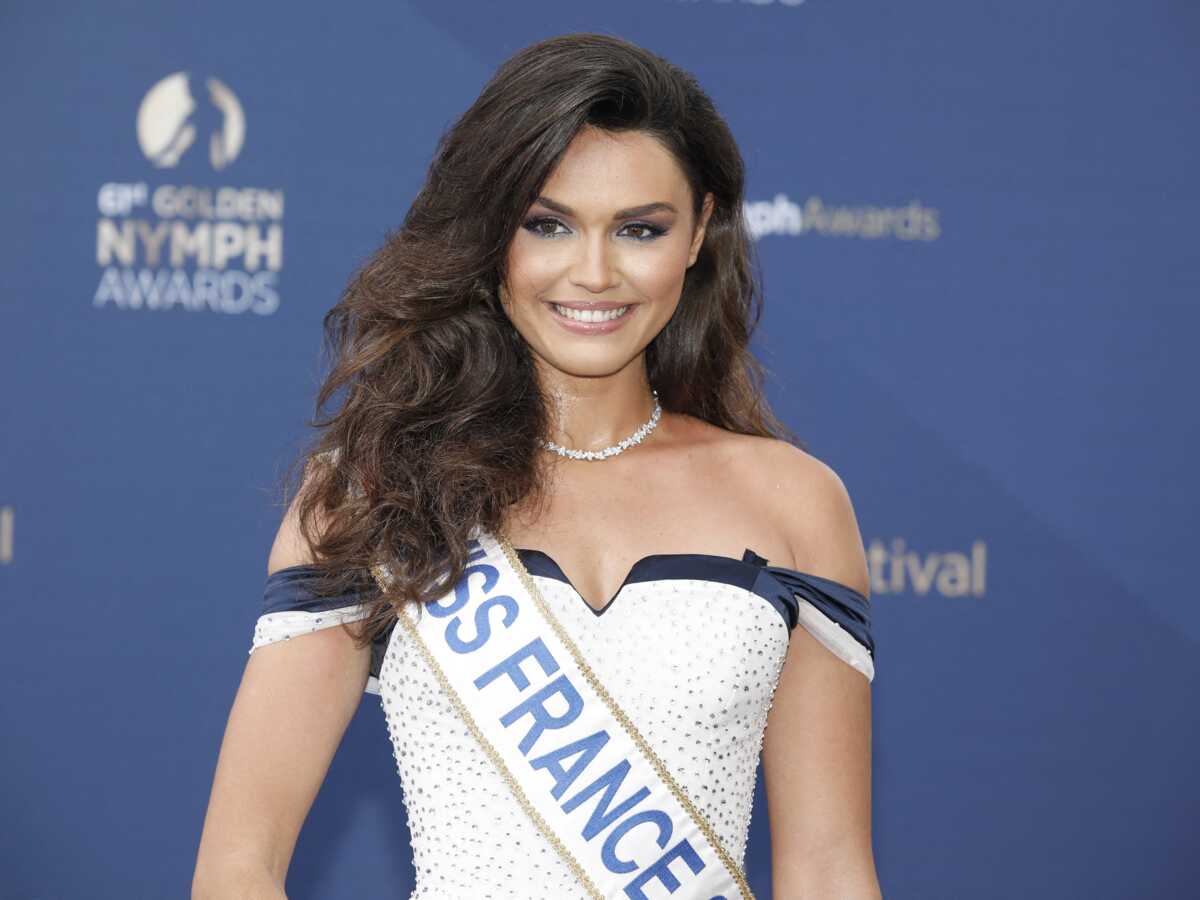 Diane Leyre : comment Miss France 2022 s’est-elle cassée une dent ?