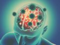 Maladie d'Alzheimer : ces deux virus pourraient déclencher son apparition