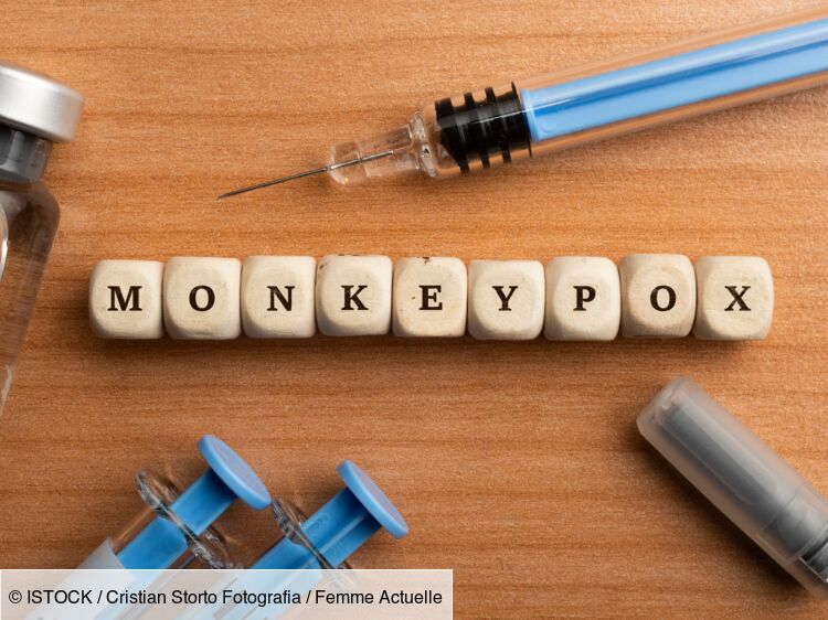 Variole du singe : découvrez pourquoi le nom de la maladie va changer