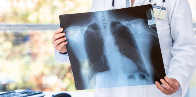 Pneumothorax : les symptômes à reconnaître pour réagir au plus vite