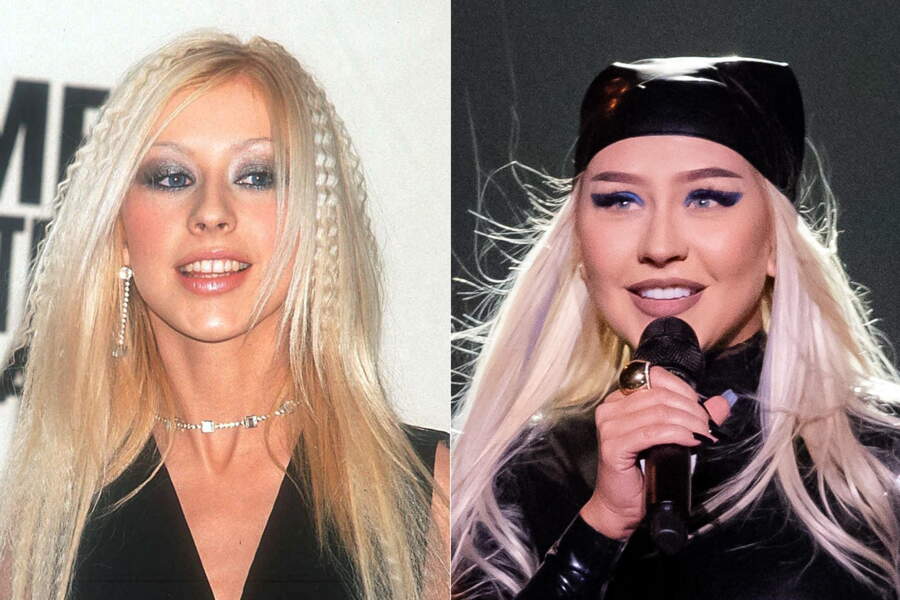 Avant/après ces stars qui ont refait leurs dents Femme Actuelle