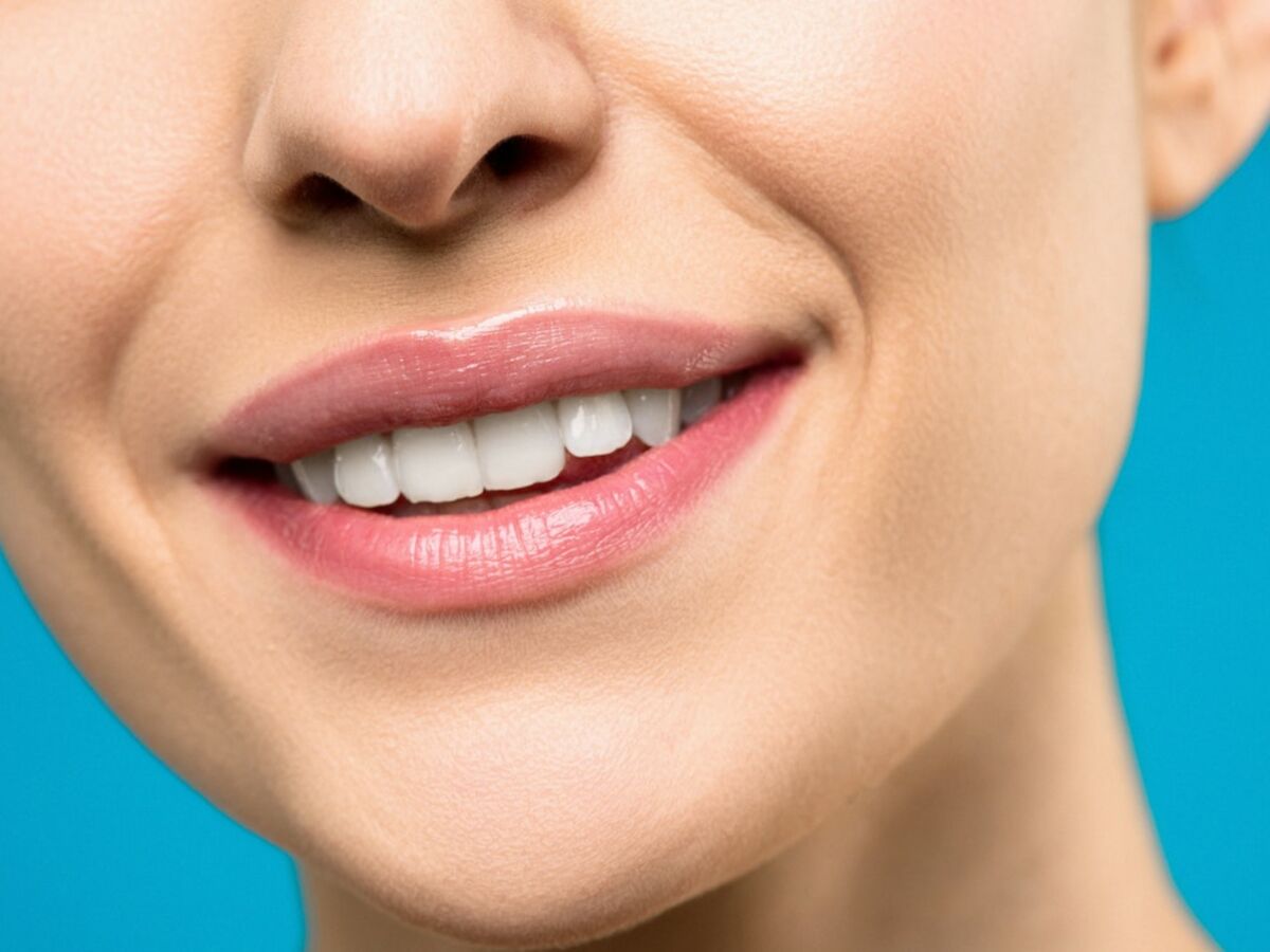Implant dentaire : quelles sont les alternatives ?