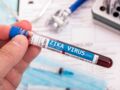 Zika : les symptômes caractéristiques de ce virus transmis par certains moustiques
