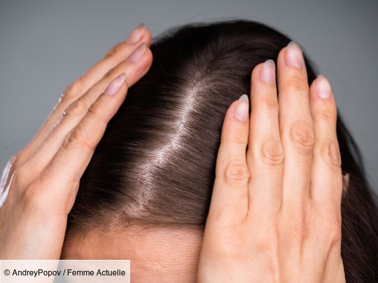 Cheveux fins, clairsemés : comment leur redonner de la force et du volume ?