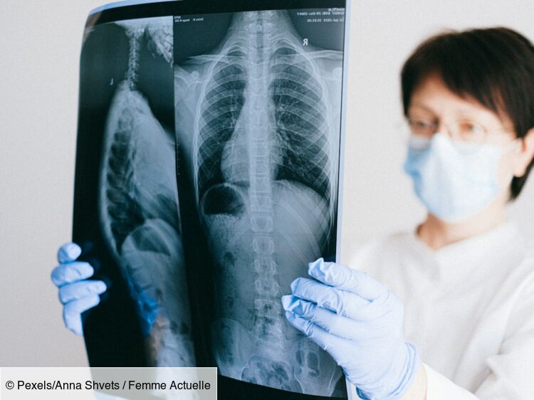 Asbestose : symptômes et traitements de cette lésion pulmonaire causée par l’amiante