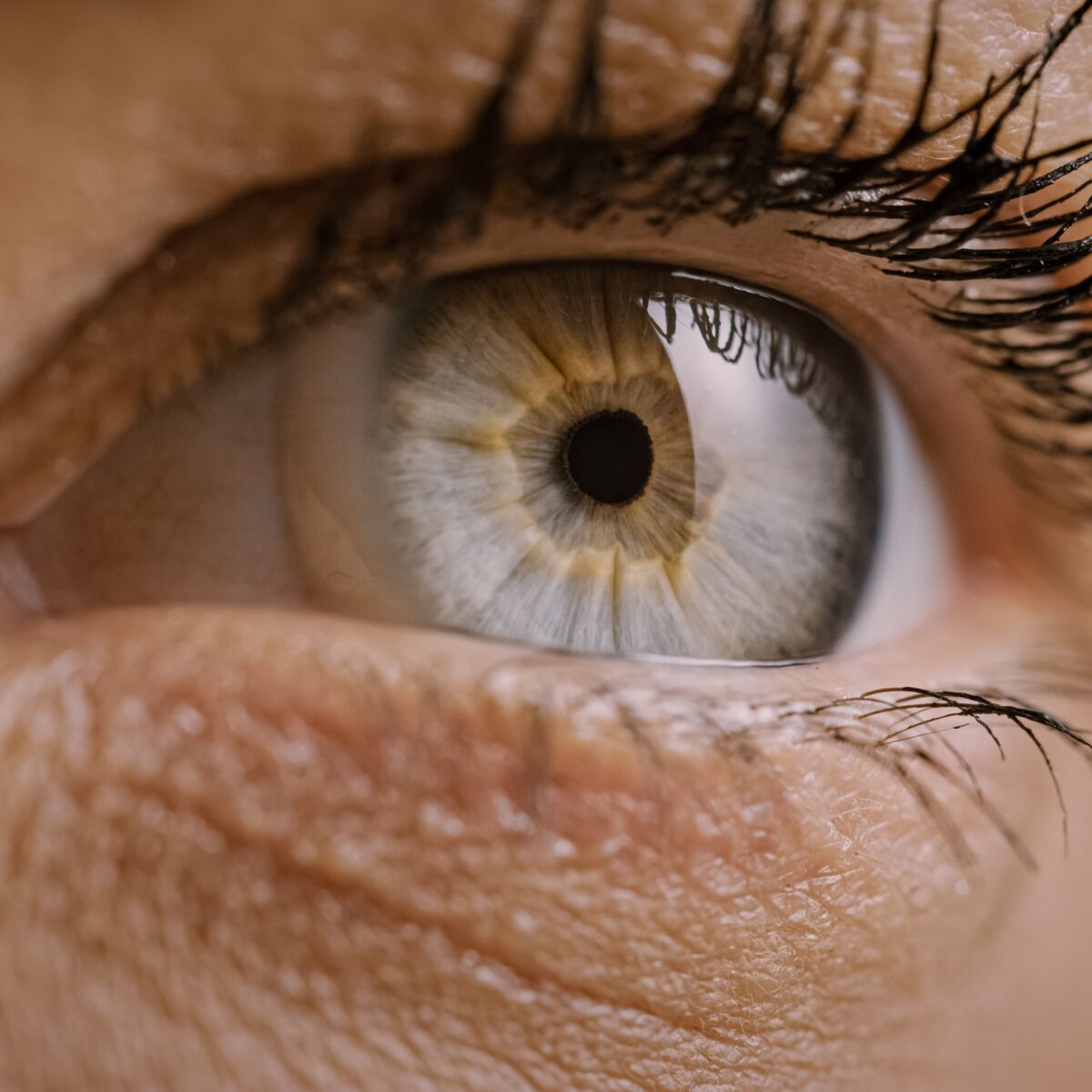 Tache dans l'œil : quelles sont les causes de ce trouble de la vision ? :  Femme Actuelle Le MAG