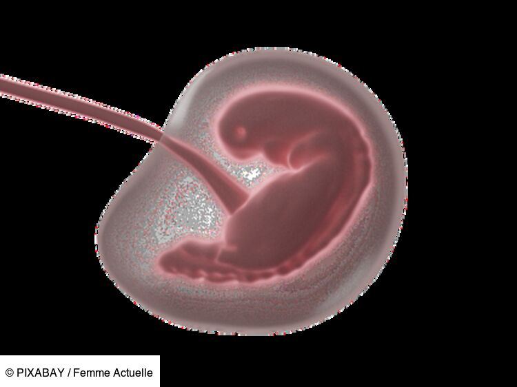 Embryon Définition Différence Avec Le Foetus Développement Femme Actuelle Le Mag 