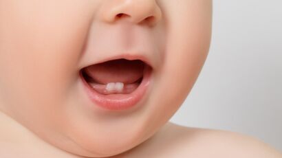 Le collier d'ambre pour les dents de bébé, ça marche ou pas? - Bien dans sa  peau