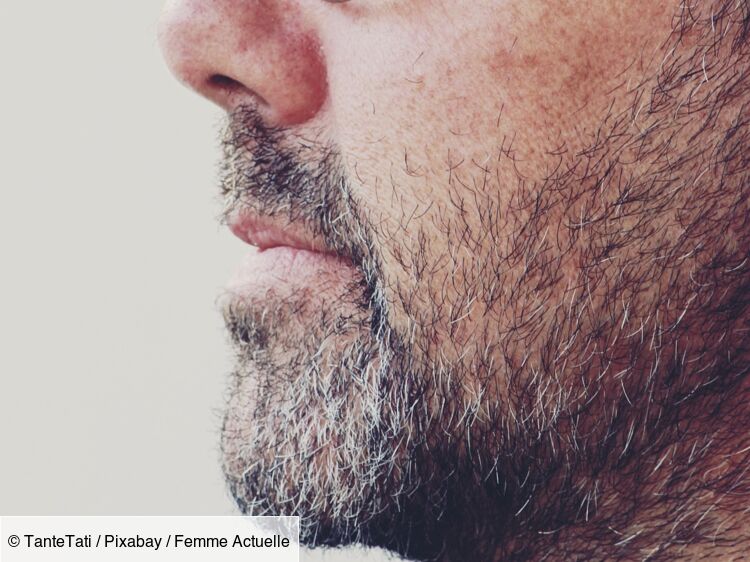 Il a le visage le plus poilu au monde : atteint du syndrome du loup-garou, cet Indien entre dans le Guinness des records