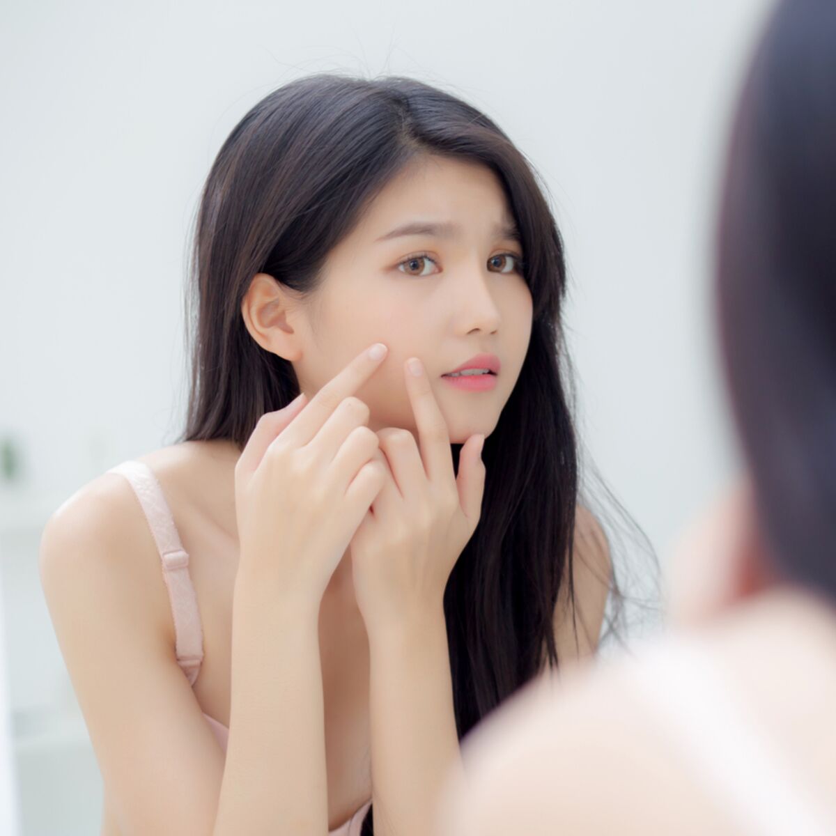 Microkyste au visage : comment s'en débarrasser ? : Femme Actuelle ...