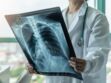 Nodule au poumon : symptômes, opération, traitements
