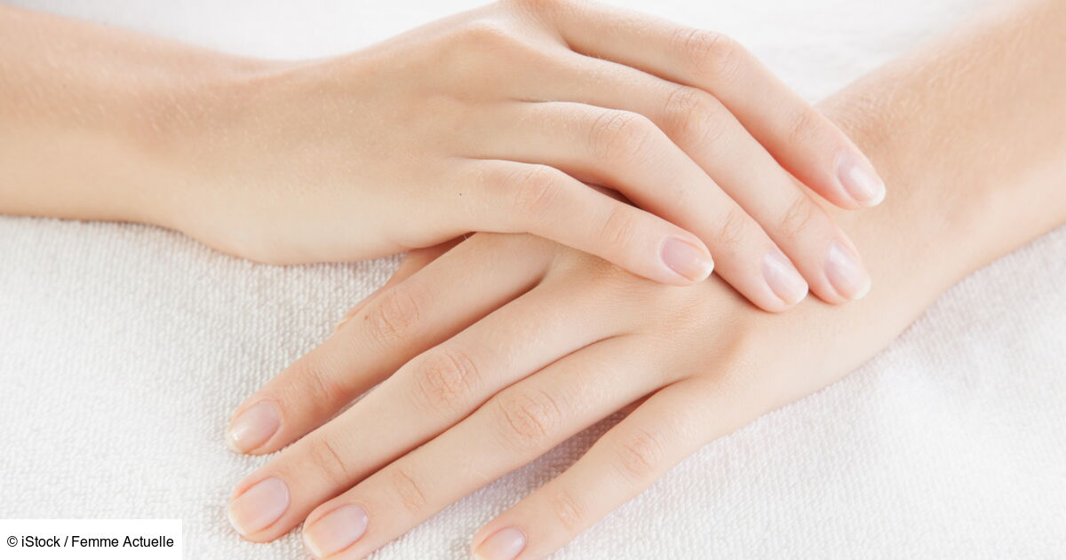 Ongles abîmés 5 astuces pour les réparer Femme Actuelle Le MAG — free download