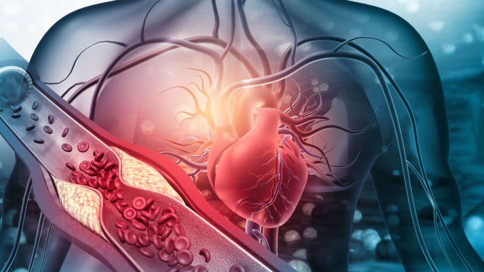 Artères coronaires : fonctions, maladies et traitements