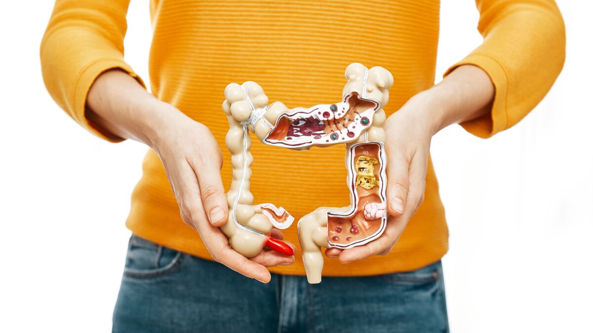 Maladie de Crohn : diagnostic, symptômes et traitements : Femme Actuelle Le  MAG