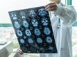 Une maladie neurologique contagieuse découverte au Canada inquiète les scientifiques