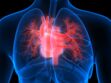 Artère pulmonaire : besoins, fonctions et maladies