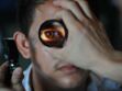 Le bulbe de l’œil : pathologies, examens et traitements