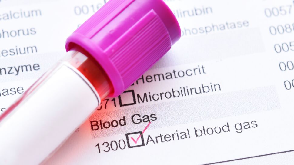 Gaz du sang (gazométrie artérielle) : définition, déroulement et nécessité