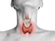 Thyroïdectomie : définition, déroulement et les examens complémentaires