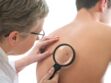 Cancer de la peau : dépistage, symptômes, traitements