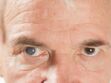 Cataracte : définition, causes, symptômes, opération, traitements