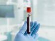 Tests sérologiques : peut-on différencier les anticorps du vaccin de ceux du Covid-19 ?
