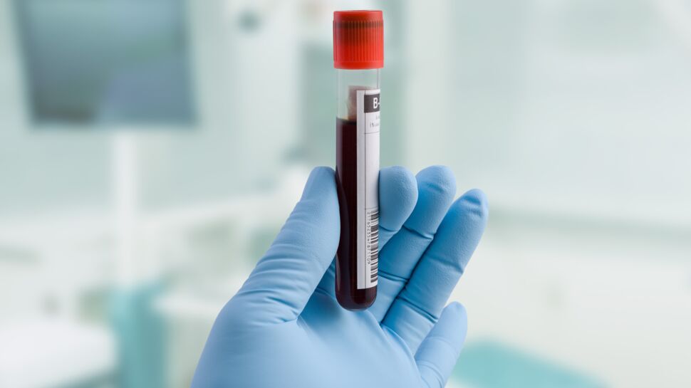 Tests sérologiques : peut-on différencier les anticorps du vaccin de ceux du Covid-19 ?