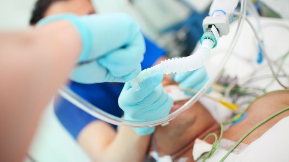 Intubation : fonction, déroulement et effets indésirables
