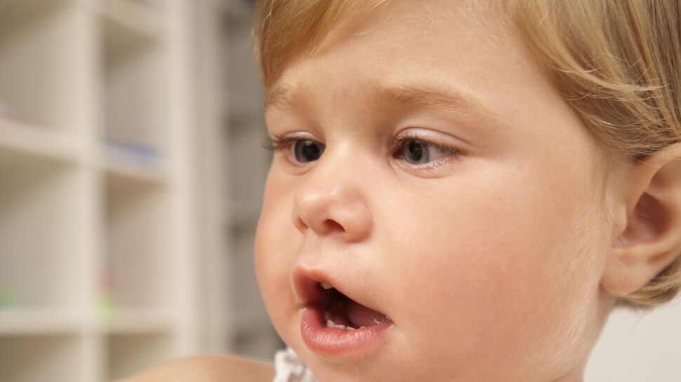 Strabisme de bébé : causes, traitements, comment le corriger et quand s'inquiéter ?