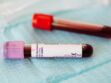 Hématologiste : définition, déroulement d'une consultation et quand consulter ce spécialiste du sang 