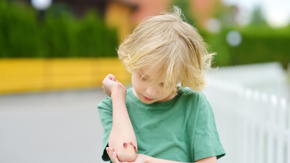 Coupures, plaies, bleus : comment soigner les blessures courantes chez les enfants 