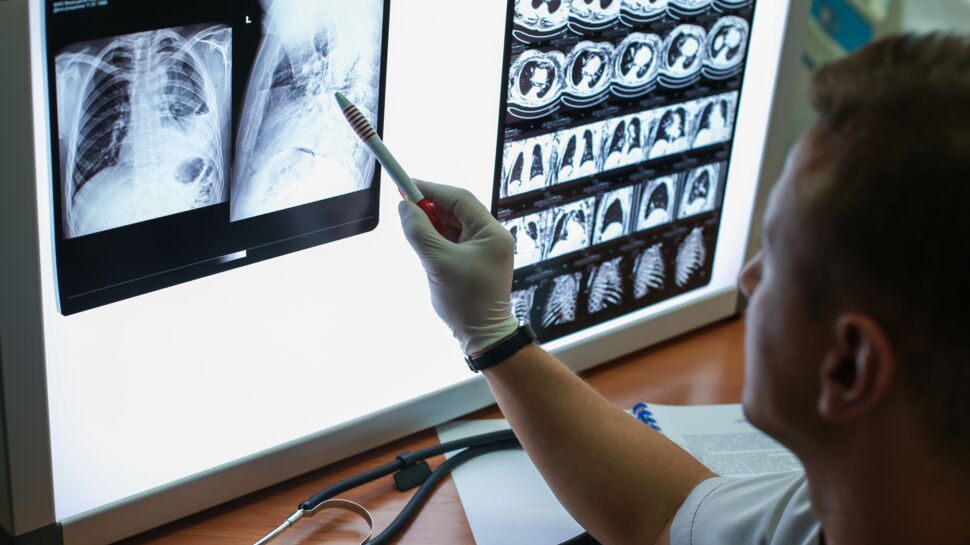 Cancer du poumon : un nouveau traitement réduirait les risques de décès à 40%, selon une étude