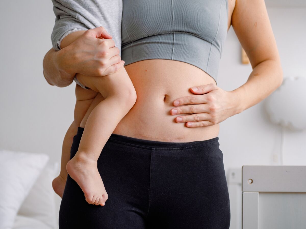 8 astuces pour raffermir son ventre après la grossesse : Femme Actuelle Le  MAG