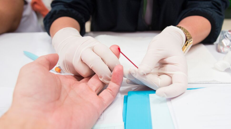 Dépistage du SIDA (VIH): en quoi consiste le test et où peut-on le faire ?