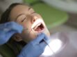 Kyste dentaire : causes, symptômes, évolution, complications, traitement