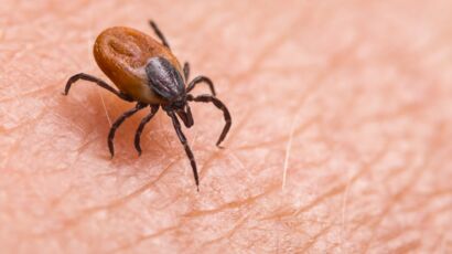 Lyme disease: what we know about the vaccine expected for 2025