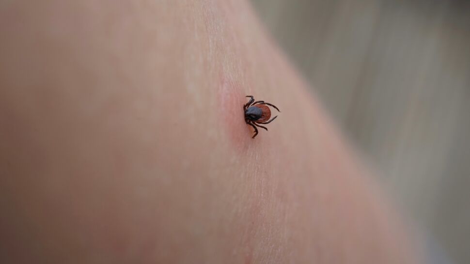 Maladie de Lyme : les symptômes à surveiller après une morsure de tiques