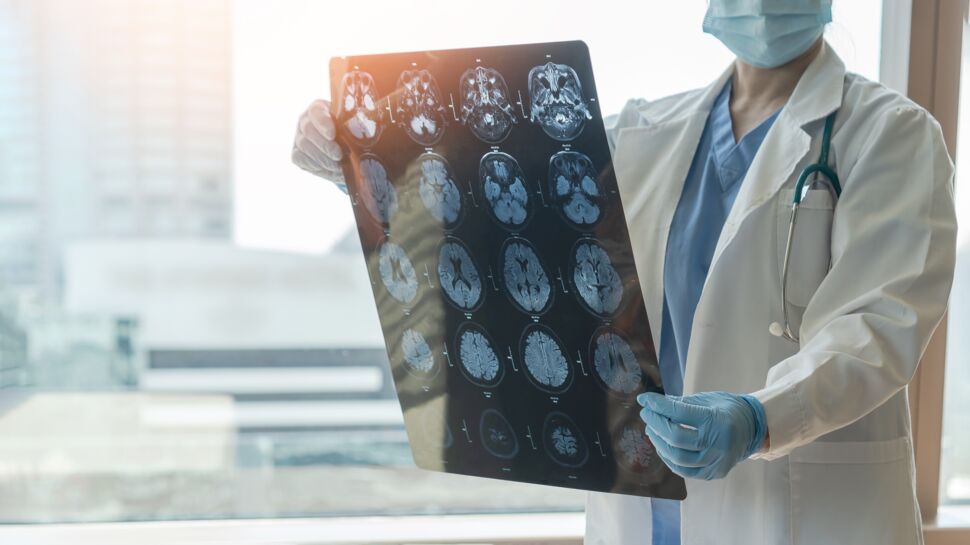 Alzheimer, Parkinson… Les premiers signes pourraient être détectés 9 ans avant le diagnostic